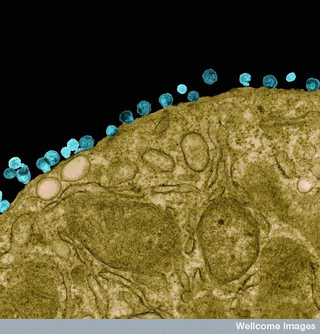 Illustration for article titled Will we ever have an HIV vaccine?